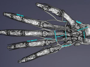 Upper limb arteries- axilla arm forearm hand 3D Model