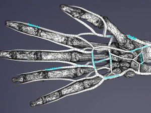 Upper limb arteries- axilla arm forearm hand 3D Model