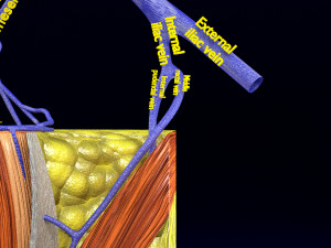 3D hemorrhoids CLEANED UP model 3D-Modell
