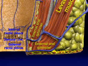 3D hemorrhoids CLEANED UP model 3D-Modell