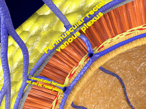 3D hemorrhoids CLEANED UP model 3D-Modell