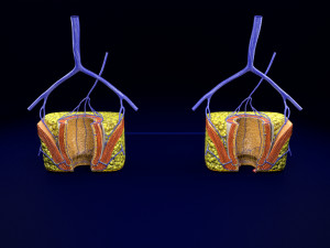 3D hemorrhoids CLEANED UP model 3D-Modell