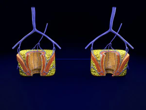 3D hemorrhoids CLEANED UP model 3D Model