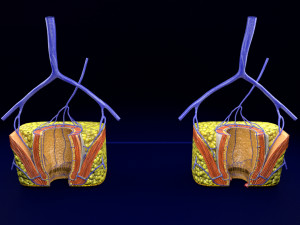 3D hemorrhoids CLEANED UP model 3D-Modell