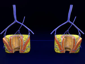 3D hemorrhoids CLEANED UP model 3D Model