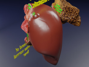 3D Liver cancer HCC vs Metastatic 3D Model