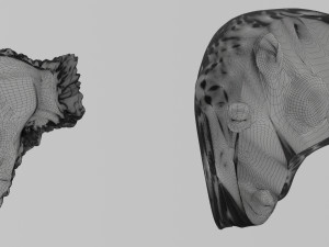 3D Liver cancer HCC vs Metastatic 3D Model
