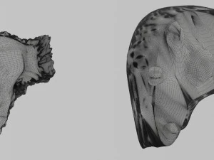 3D Liver cancer HCC vs Metastatic 3D Model