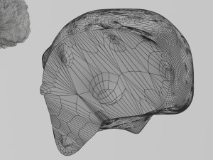 3D Liver cancer HCC vs Metastatic 3D Model