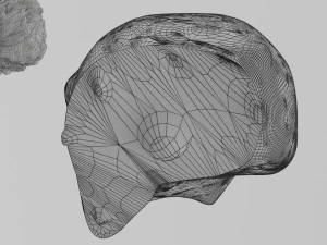 3D Liver cancer HCC vs Metastatic 3D Model