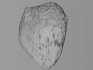 3D Liver cancer HCC vs Metastatic 3D Model