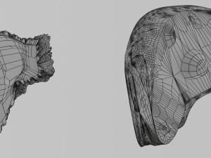 3D Liver cancer HCC vs Metastatic 3D Model