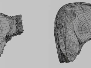 3D Liver cancer HCC vs Metastatic 3D Model