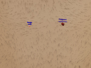 Mole nevus cancer Malignant melanoma differences 3D Modelo 3D