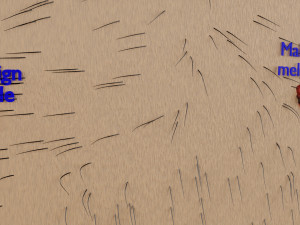 Mole nevus cancer Malignant melanoma differences 3D Modelo 3D