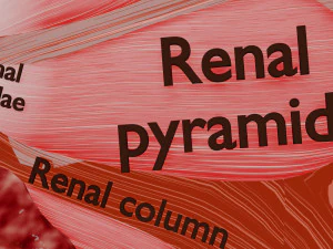Renal cell carcinoma 3D Model
