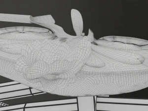 Renal cell carcinoma 3D Model