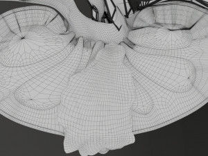 Renal cell carcinoma 3D Модель