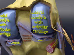 Osteoarthritis stages 3D Modelo 3D