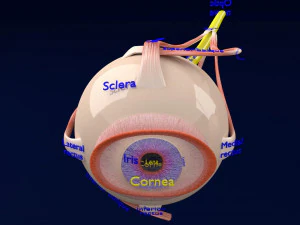 Posterior vitreous detachment types eye 3D Model