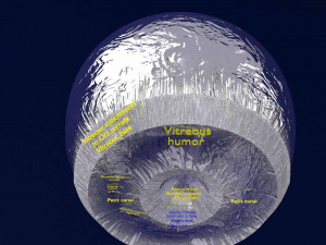 Posterior vitreous detachment types eye Modelo 3D