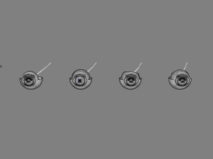 Posterior vitreous detachment types eye 3D Model