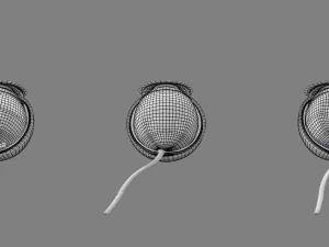 Posterior vitreous detachment types eye 3D Model
