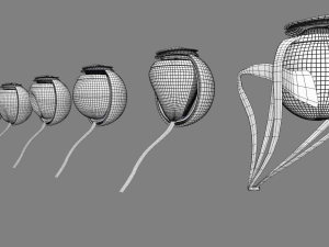 Posterior vitreous detachment types eye Modelo 3D