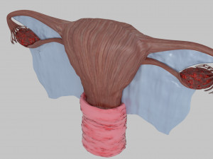 Uterus 3D 模型
