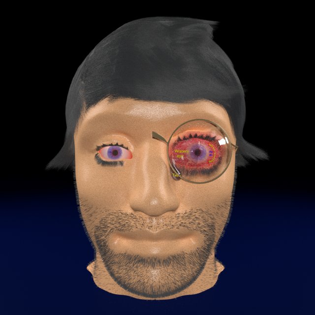 3D thyroid eye disease Model 3D .c4d .max .obj .3ds .fbx .stl .blend 