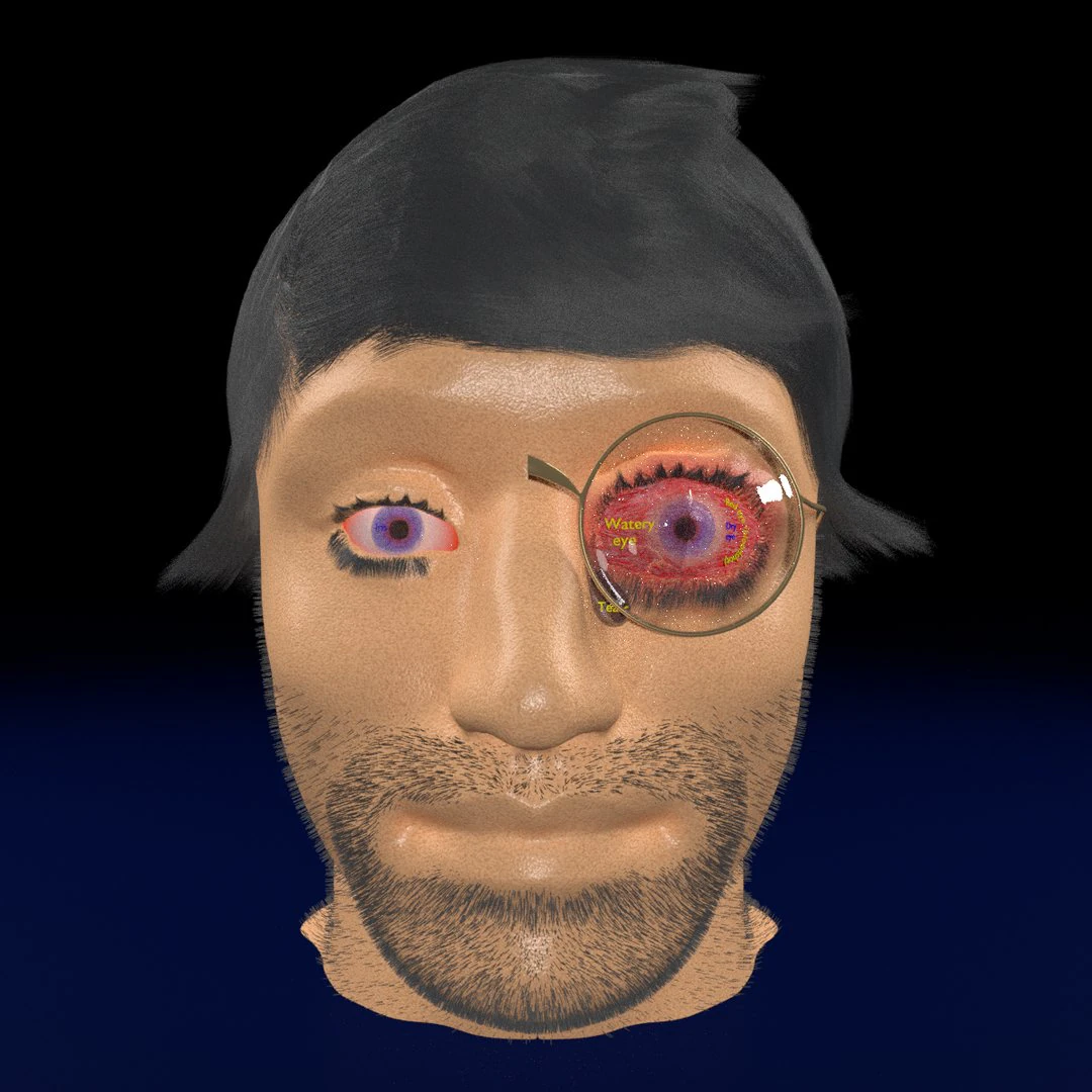 3D thyroid eye disease 3D Model .c4d .max .obj .3ds .fbx .stl .blend