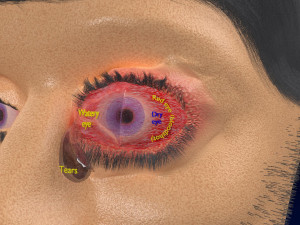 3D thyroid eye disease Model 3D