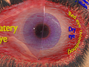 3D thyroid eye disease Model 3D