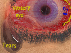 3D thyroid eye disease Model 3D