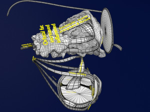 3D thyroid eye disease Model 3D