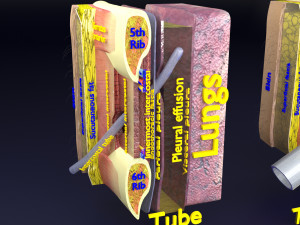 3D thoracic procedures Modelo 3D