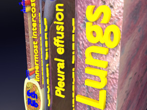 3D thoracic procedures Modelo 3D