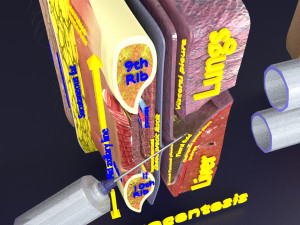 3D thoracic procedures Modelo 3D
