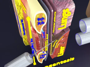 3D thoracic procedures 3D Model
