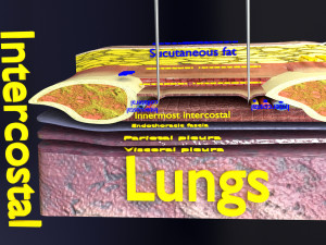 3D thoracic procedures Modelo 3D