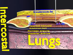 3D thoracic procedures 3D Model