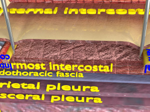 3D thoracic procedures Modelo 3D