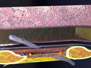 3D thoracic procedures Modelo 3D