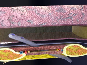3D thoracic procedures 3D Model
