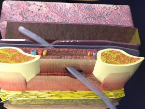 3D thoracic procedures Modelo 3D