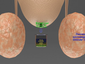 Seminal fluid according to cause of azoospermia 3D 模型