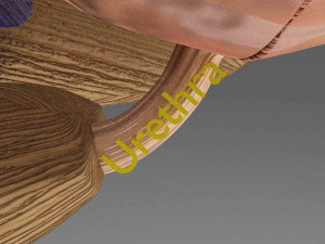 Seminal fluid according to cause of azoospermia 3D 模型