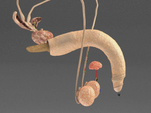 Seminal fluid according to cause of azoospermia 3D 模型
