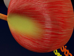 Retinal detachment types eye 3D Model