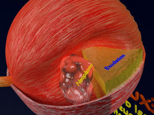 Retinal detachment types eye Modelo 3D